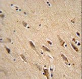 ARF1 Antibody (aa80-106)