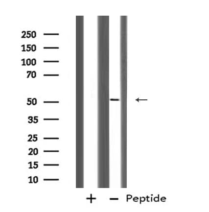 Polyclonal Rabbit anti-Human KRT12 / CK12 / Cytokeratin 12 Antibody (WB)