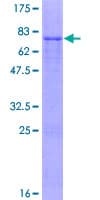 Human IPMK Protein (Recombinant GST)
