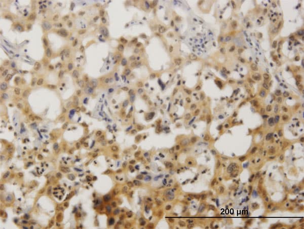 ZNF496 / NZIP1 Antibody (clone 2B3)