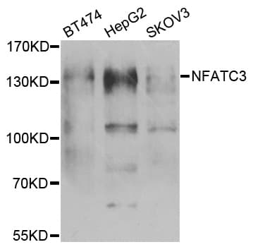 NFAT4 / NFATC3 Antibody