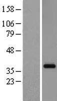 GPR26 Protein (Over-Expression Lysate Myc-DDK (Flag))