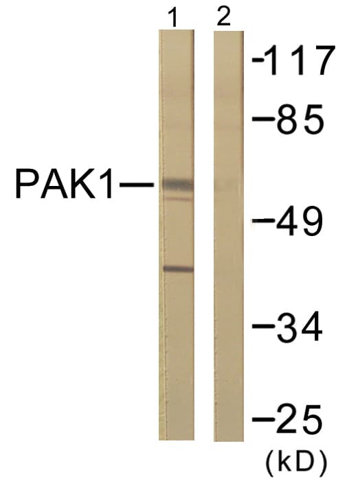 IHC-plus™ PAK1 Antibody (aa178-227)