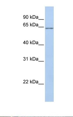ANGPTL2 / ARP2 Antibody (aa72-121, HRP)