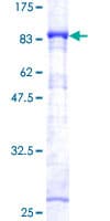 Human AKT3 Protein (Recombinant GST)