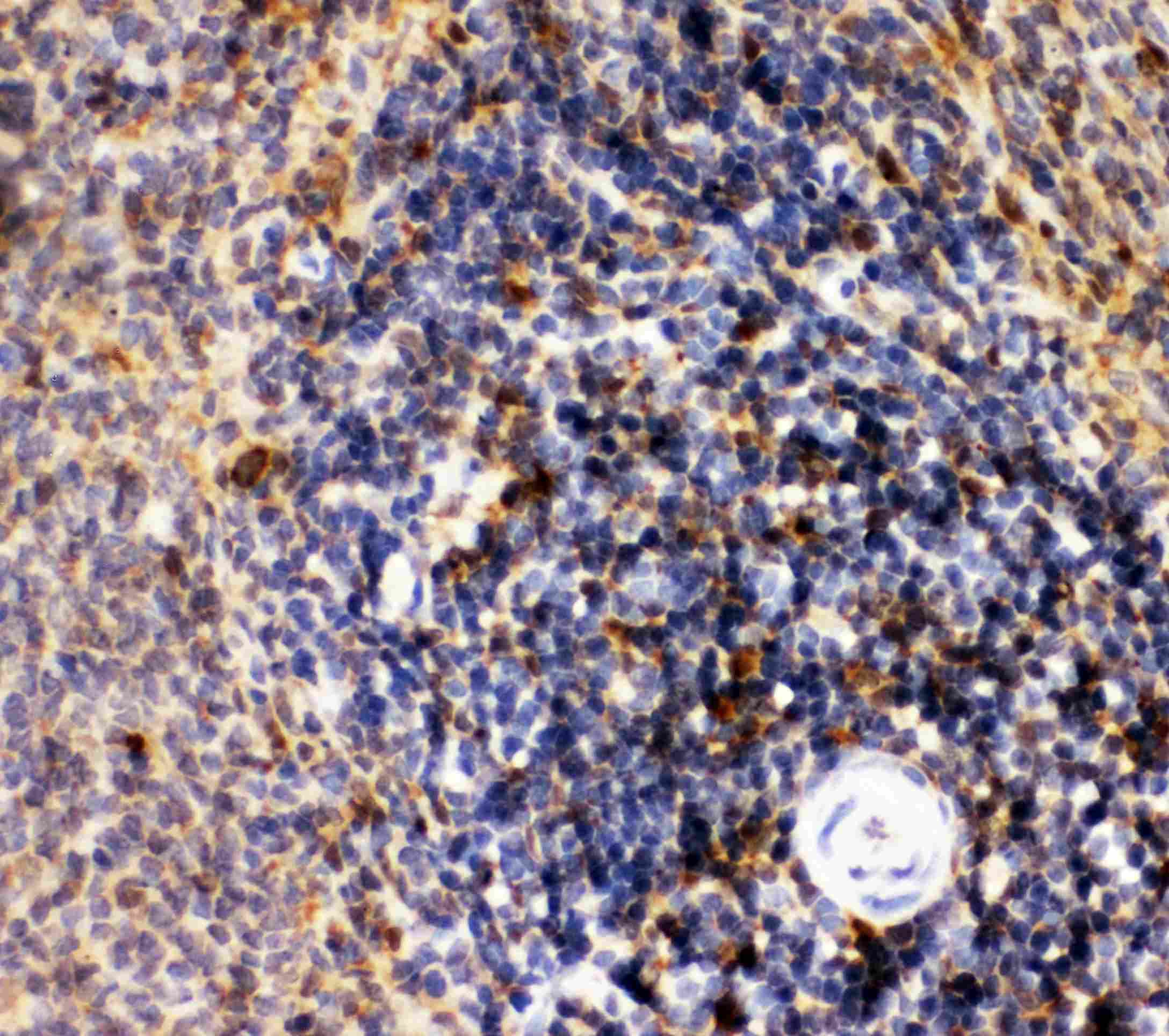 MME / CD10 Antibody (aa52-750)