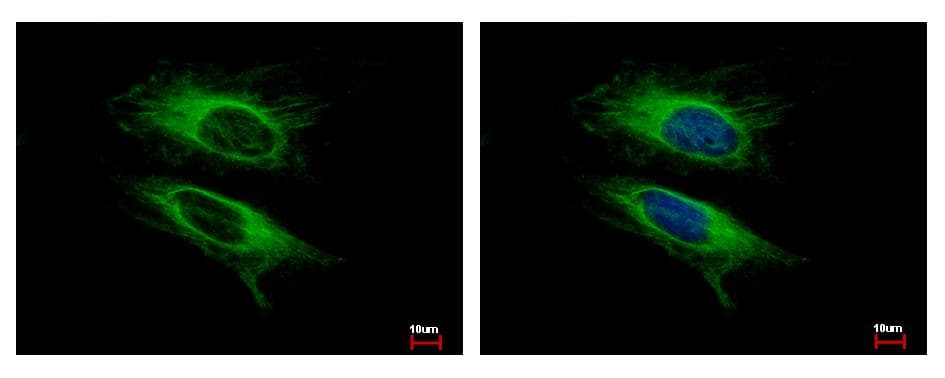 Polyclonal Rabbit anti-Human VPS11 Antibody (aa300-392, WB)