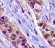 NAPSA / NAPA / Napsin A Antibody (N-Terminus, clone TMU-Ad02)