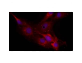 NCAN / Neurocan Antibody (clone 650.24)