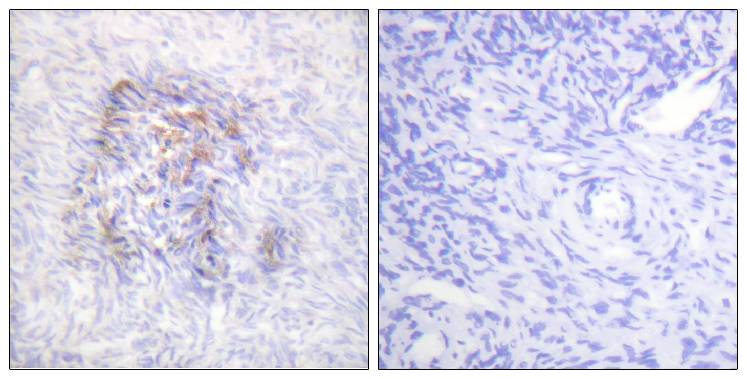 ACO1 / Aconitase Antibody (phospho-Ser138)