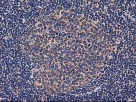 GRHPR / Glyoxylate Reductase Antibody (clone OTI2H4)