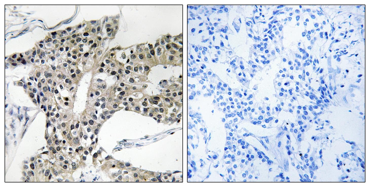ARSK / Arylsulfatase K Antibody