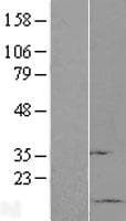 Human SUMO1 / SMT3 Protein (Over-Expression Lysate Myc-DDK (Flag))