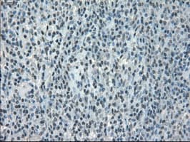 CRYAB / Alpha B Crystallin Antibody (clone OTI3C2)