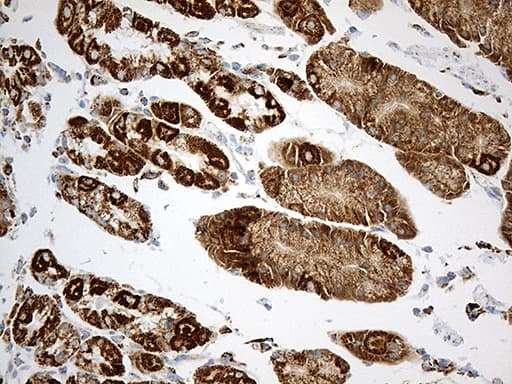 MCAD / ACADM Antibody (clone OTI2G7)
