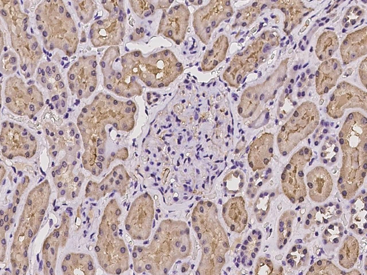 CNDP2 Antibody