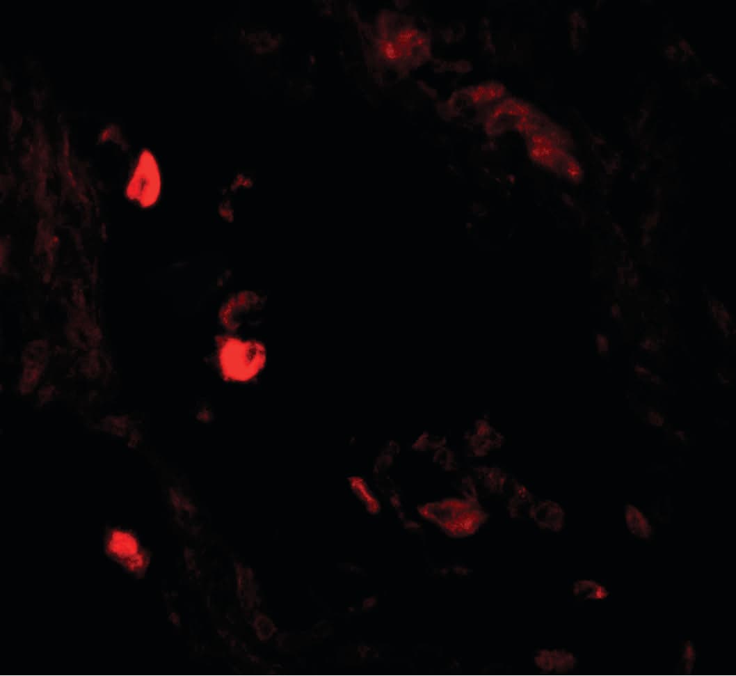 IHC-plus™ LNPEP Antibody