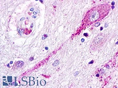 PathPlus™ ACKR2 / CCR10 / D6 Antibody (Internal)
