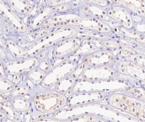 Polyclonal Rabbit anti-Human HNF4A / HNF4 Antibody (phospho-Ser313, IHC, IF, WB)