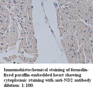 Polyclonal Rabbit anti-Human MT-ND2 Antibody (N-Terminus, IHC)