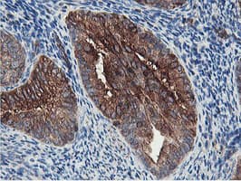 PFKP Antibody (clone OTI5F7)
