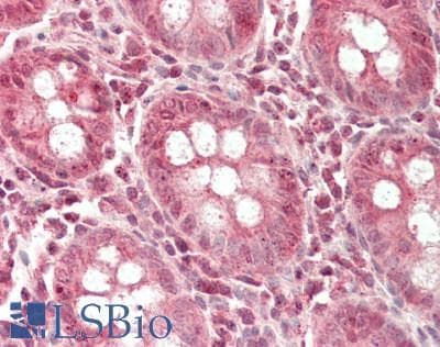 IHC-plus™ BRCC3 / BRCC36 Antibody (aa2-316)