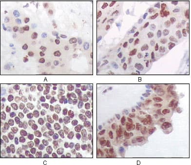 MAPKAPK5 / PRAK Antibody (clone 7H10B4)