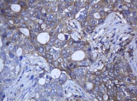 RAB21 Antibody (clone OTI6B1, Carrier-free)