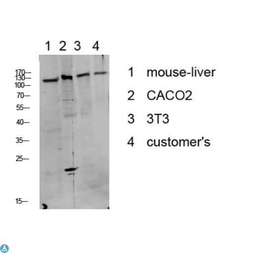 Polyclonal Rabbit anti-Human NEP / DDR1 Antibody (Tyr513, WB)