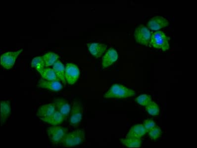 MYOZ2 / CS-1 Antibody