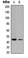 CLN5 Antibody (Internal)