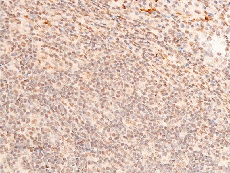 JUN / c-Jun Antibody (phospho-Thr93)