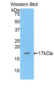 Polyclonal Rabbit anti-Human LIPC / Hepatic Lipase Antibody (aa347-478, WB)