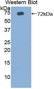 FSP27 / CIDEC Antibody (aa1-251, FITC)