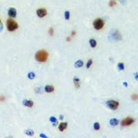 PWWP2B Antibody (Internal)