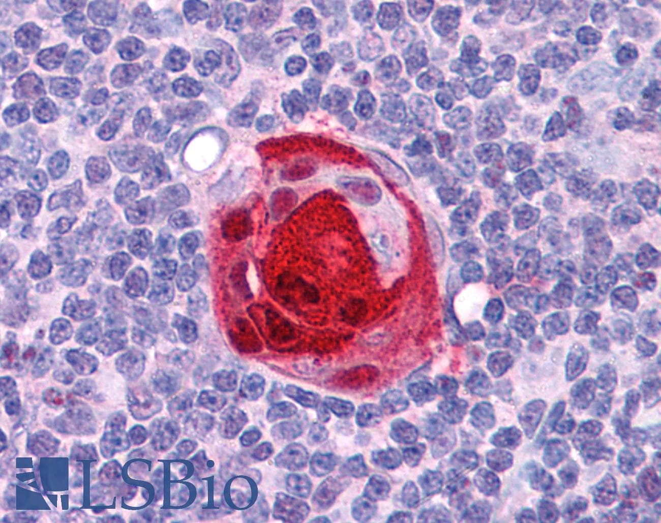 PathPlus™ SMARCA4 / BRG1 Antibody (C-Terminus, clone BRG-01)