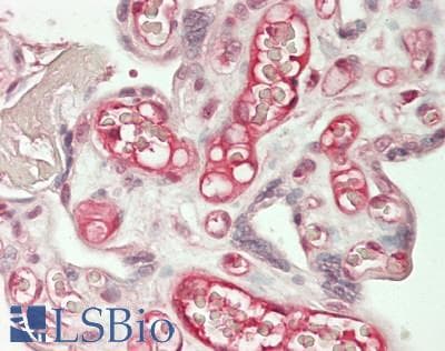 IHC-plus™ Polyclonal Rabbit anti-Human ANAPC7 / APC7 Antibody (aa75-125, IHC)
