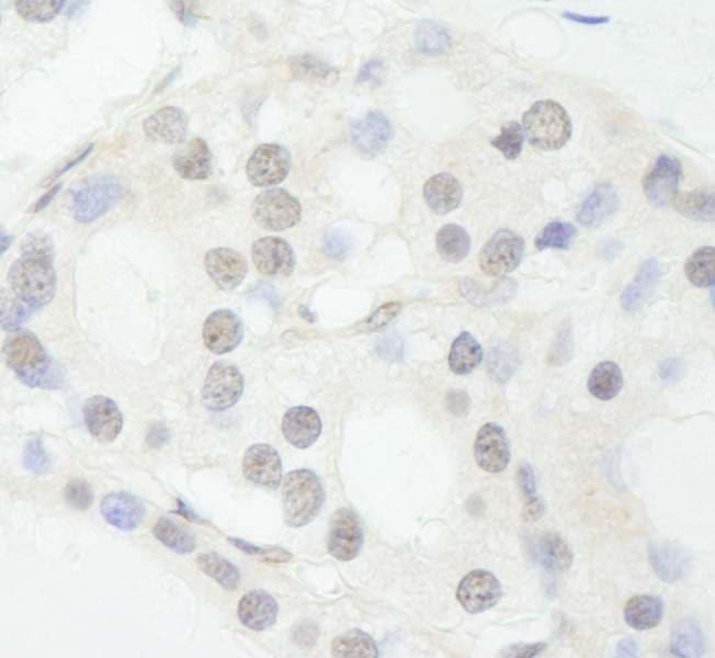 SNW1 / SKIP Antibody (aa450-500)