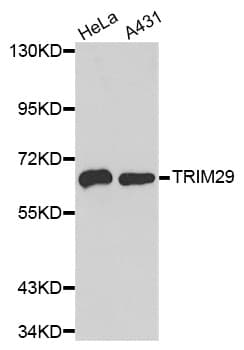Polyclonal Rabbit anti-Human TRIM29 Antibody (WB)