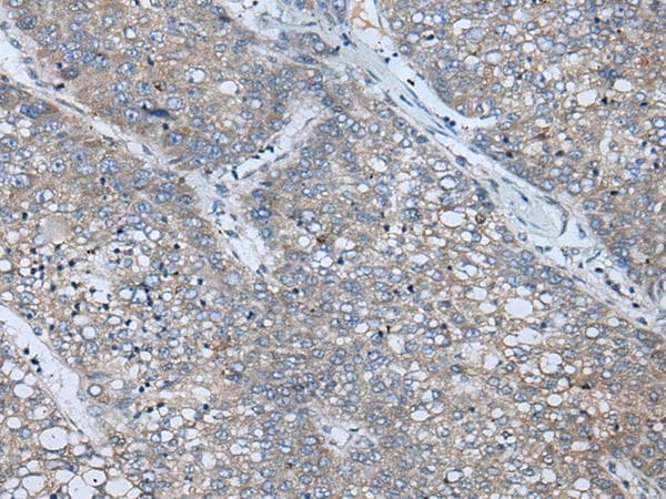 BICD2 Antibody