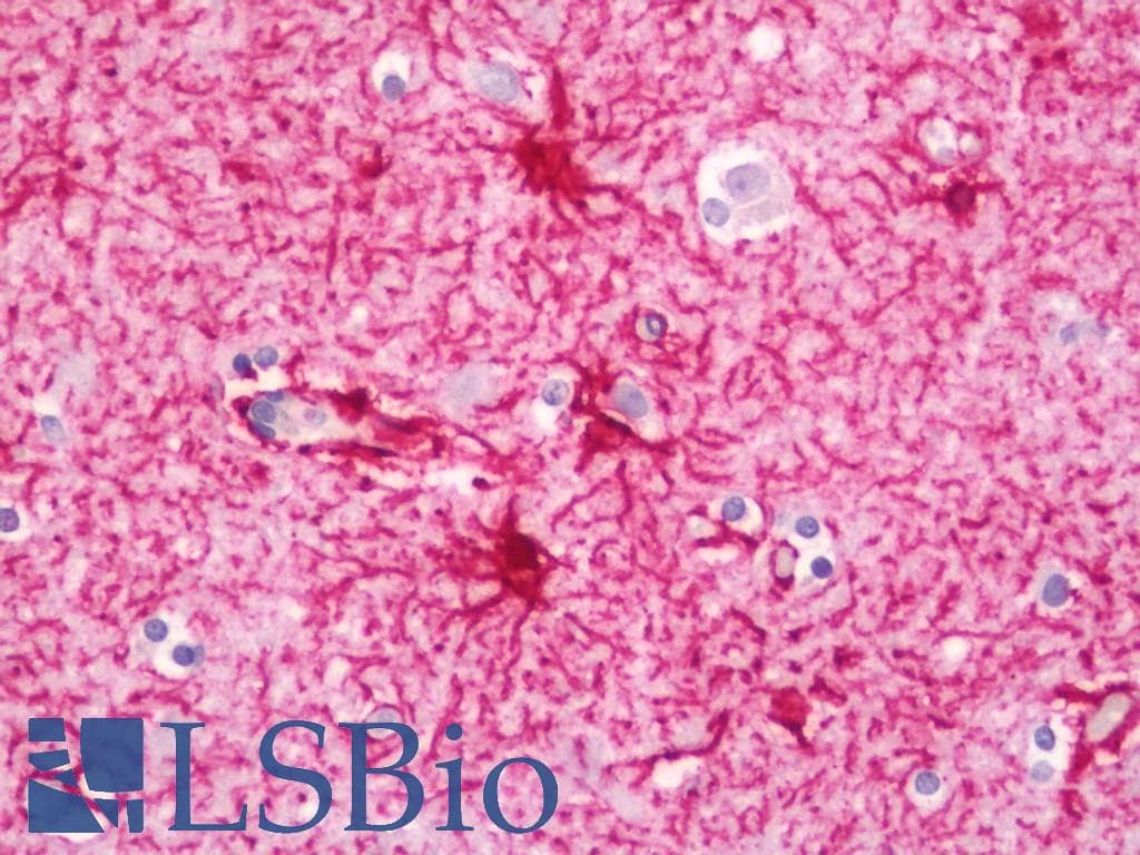 IHC-plus™ GFAP Antibody