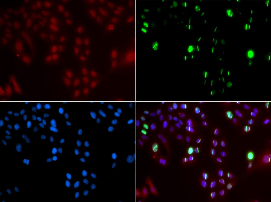 FANCD2 Antibody