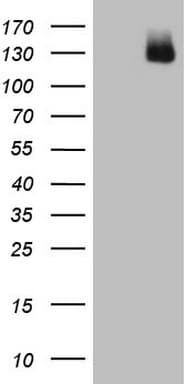 AR / Androgen Receptor Antibody (aa420-659, clone OTI3C5)
