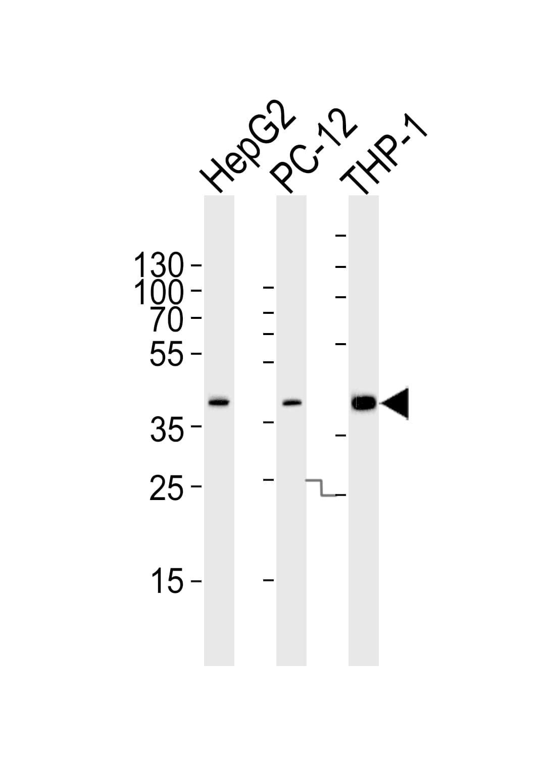 Polyclonal Rabbit anti-Human MAPK13 / p38delta Antibody (aa163-194, WB)