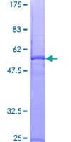 Human PRTN3 / Myeloblastin Protein (Recombinant GST)