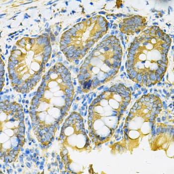 HSP90AB1 / HSP90 Alpha B1 Antibody