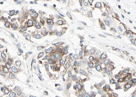 Polyclonal Rabbit anti-Human RELA / NFKB p65 Antibody (IHC, IF, WB)
