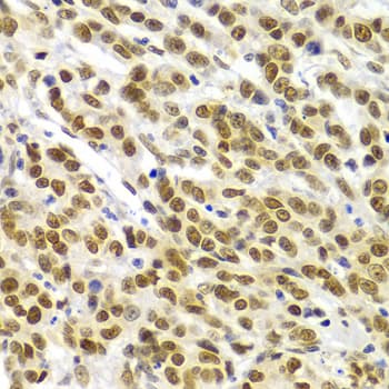 SMARCE1 / BAF57 Antibody