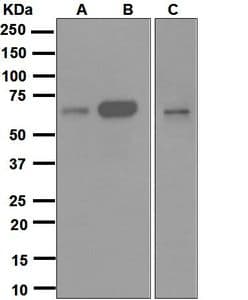 IHC-plus™ Monoclonal Rabbit anti-Human CDC25B Antibody (clone EPR3459(2), Internal, IHC, WB)