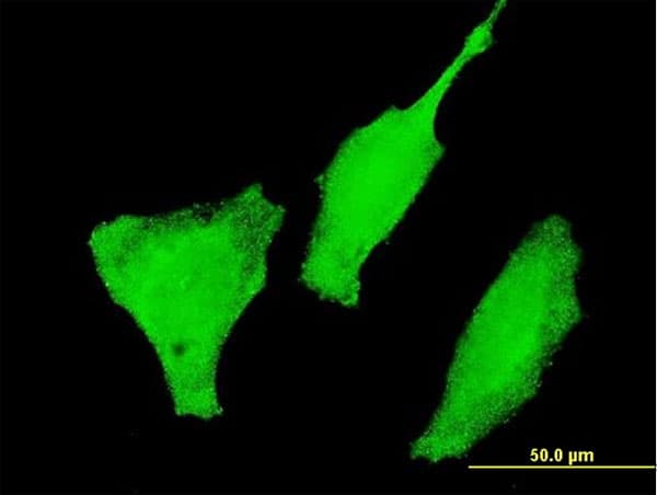 FOXO3 / FOXO3A Antibody (clone 1D2)
